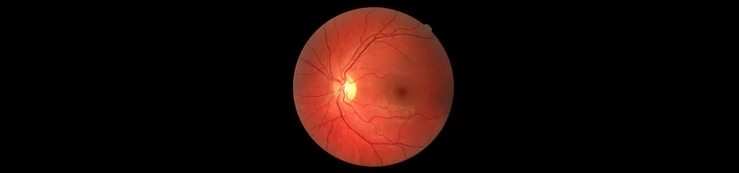 Taylors Optometrists: Digital Retinal Photographs