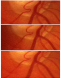 Taylors Optometrists: Digital Retinal Photographs